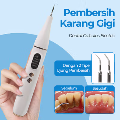 YUKU Pembersih Karang Plak Gigi Ultrasonic Dental Calculus Electric - GS5 - White