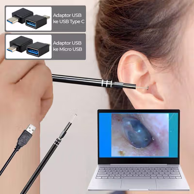 TaffOmicron Kamera Pembersih Telinga Korek Kuping Endoscope HD USB - EU-0 - Black