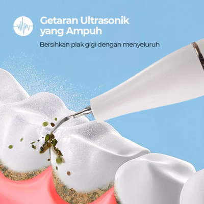 YUKU Pembersih Karang Plak Gigi Ultrasonic Dental Calculus Electric - GS5 - White — gambar 2