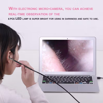 TaffOmicron Kamera Pembersih Telinga Korek Kuping Endoscope HD USB - EU-0 - Black — gambar 3