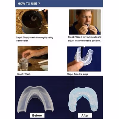 InniFun Alat Bantu Stop Dengkur Snoring Solution Mouthpiece - BC003 - Blue — gambar 4