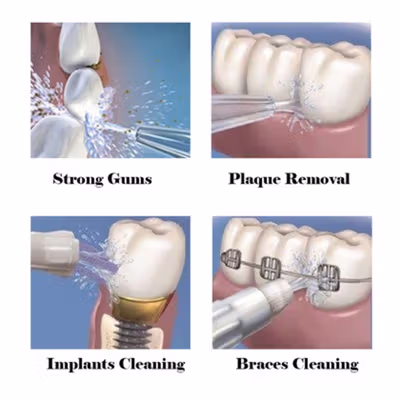 Waterpulse Dental Flosser Alat Semprot Pembersih Gigi - V400Plus - White — gambar 4