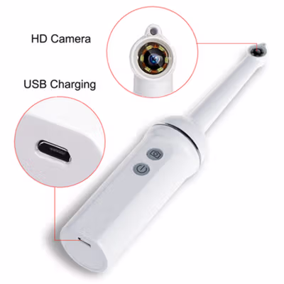 Dodosee Kamera Endoskopi Gigi Intraoral Dental Endoscope WiFi 6 LED - YC-W7 - White — gambar 4