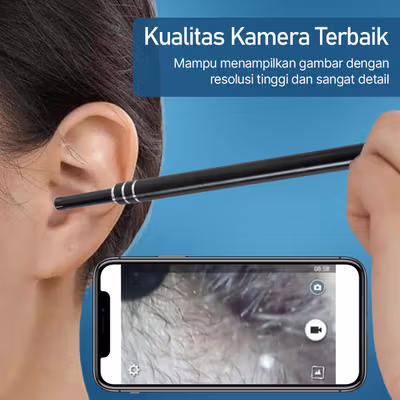 TaffOmicron Kamera Endoskop Pembersih Telinga Endoscope USB 3 in 1 - i96 - Black — gambar 4